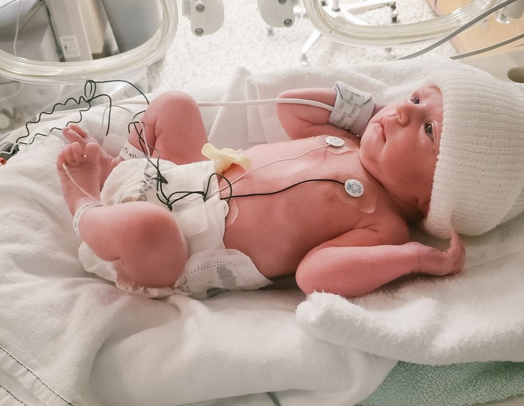 Baby in the NICU